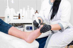 Heel Pain Canberra